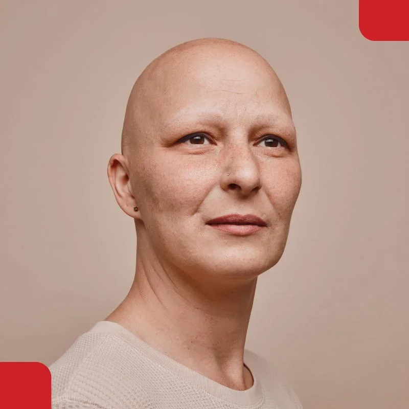 Total alopecia treatment